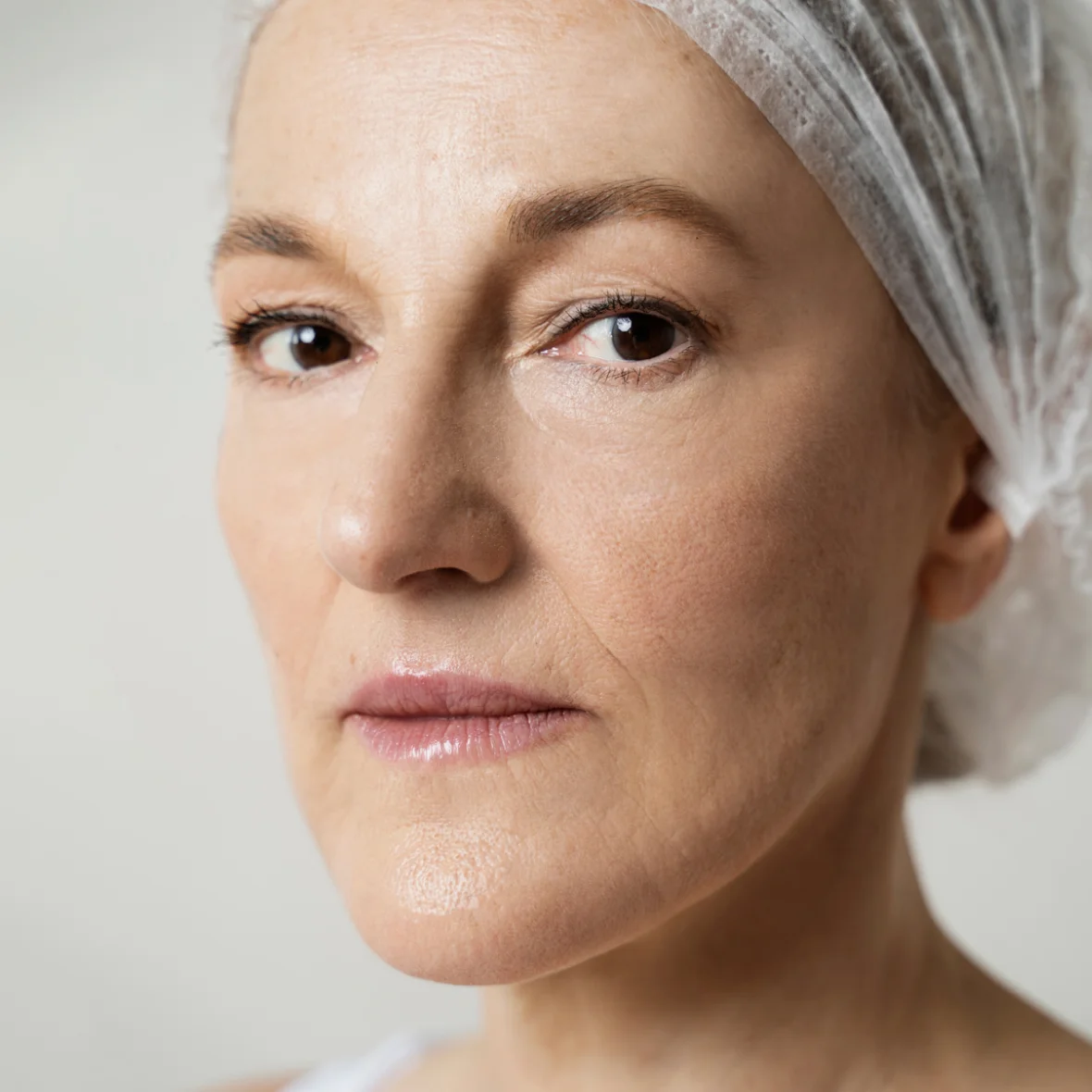 After the same treatment at Promethean Clinic in Vancouver, shown unretouched
