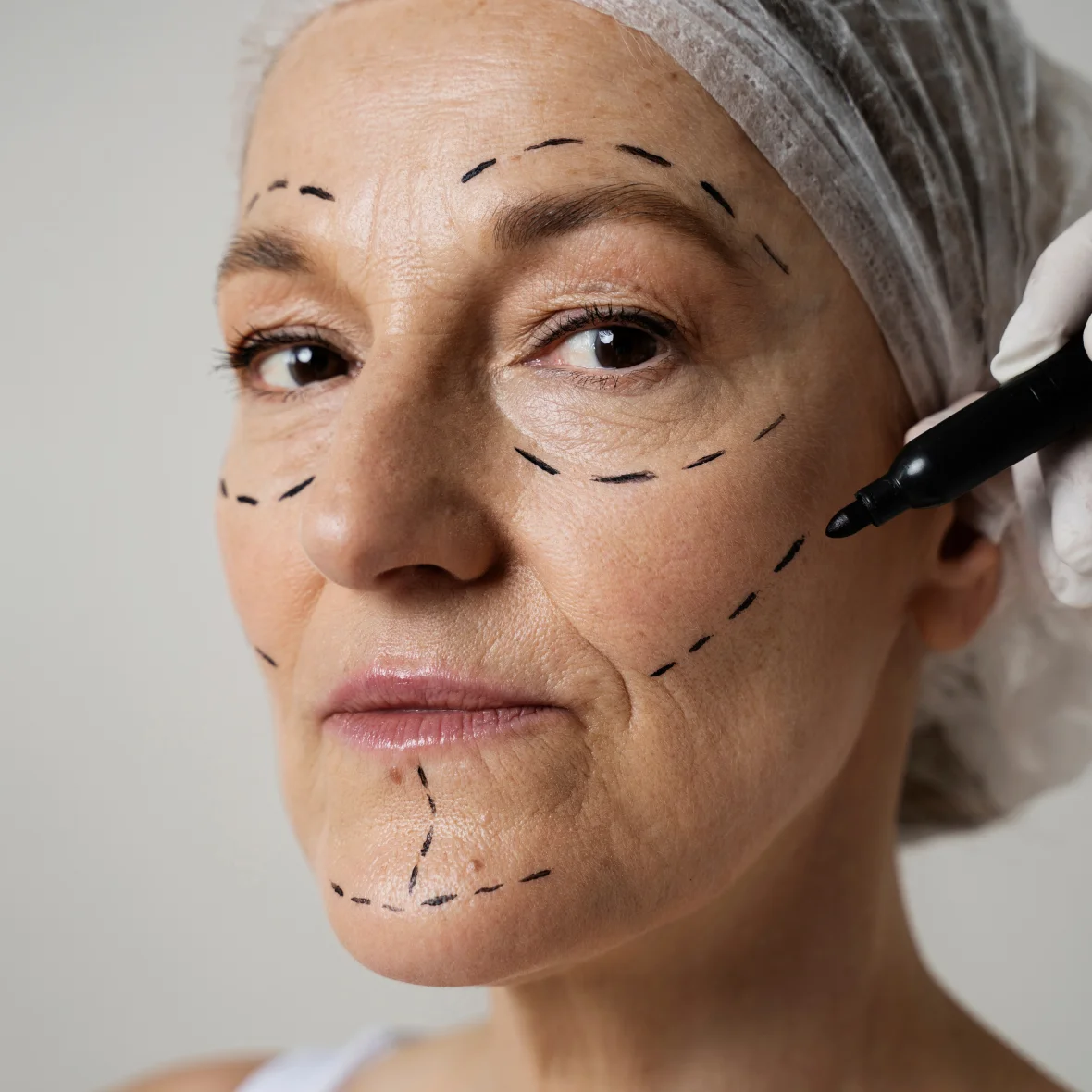 Before a treatment at Promethean Clinic in Vancouver, shown unretouched